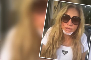 Carmen Geiss: Nach brutalem Überfall: Carmen Geiss meldet sich schwer gezeichnet und mit brüchiger Stimme