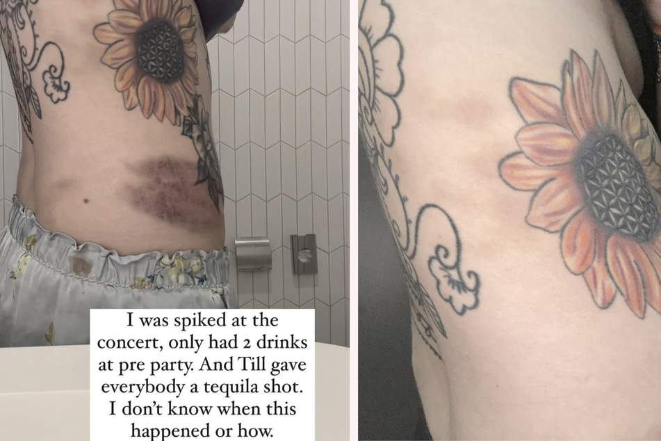 Am Tag nach dem Konzert wachte Shelby Lynn mit merkwürdigen blauen Flecken auf ihrem Körper auf.