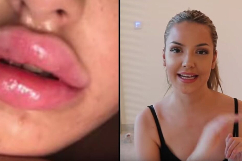 Ex-GNTM-Babe Enisa: Diesen Beauty-Eingriff bereut sie zutiefst!