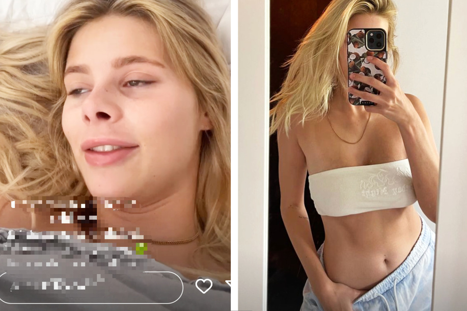 Model erlebt schlimme Vergiftung: "Mir ging's schon lange nicht mehr so scheiße"