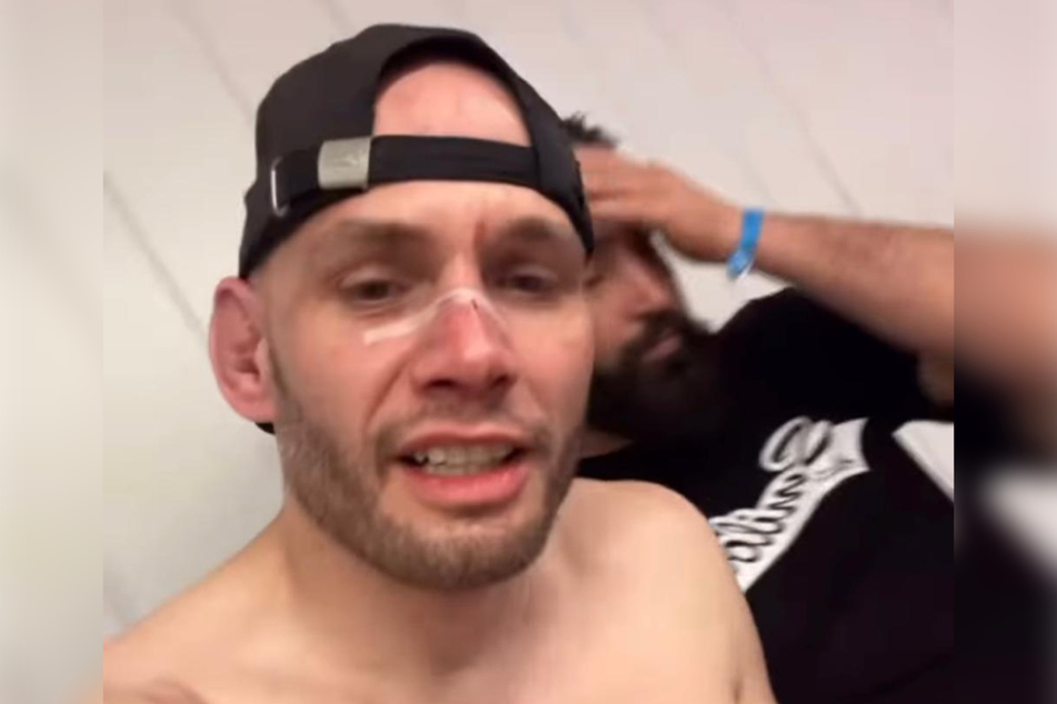 Nach dem Kampf meldete sich der YouTuber leicht lädiert, aber stolz bei seinen Fans.