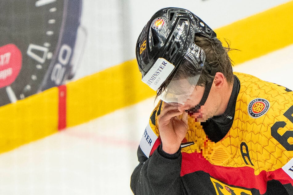 Kieferbruch! Deutschland-Star bei Eishockey-WM schwer verletzt