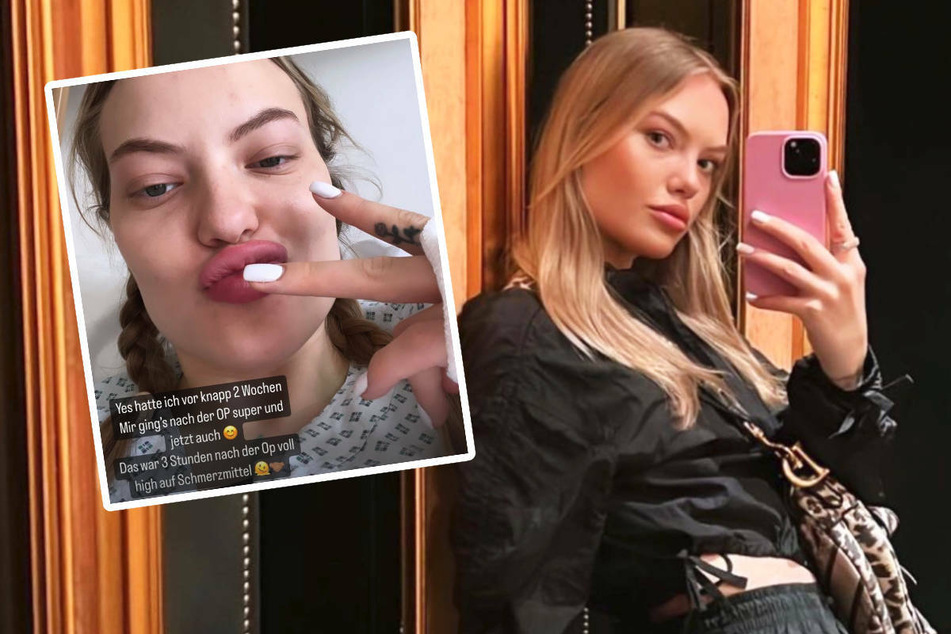 Cheyenne Ochsenknecht: Brust-OP bei Cheyenne Ochsenknecht: "Um mich endlich selbstbewusster zu fühlen"