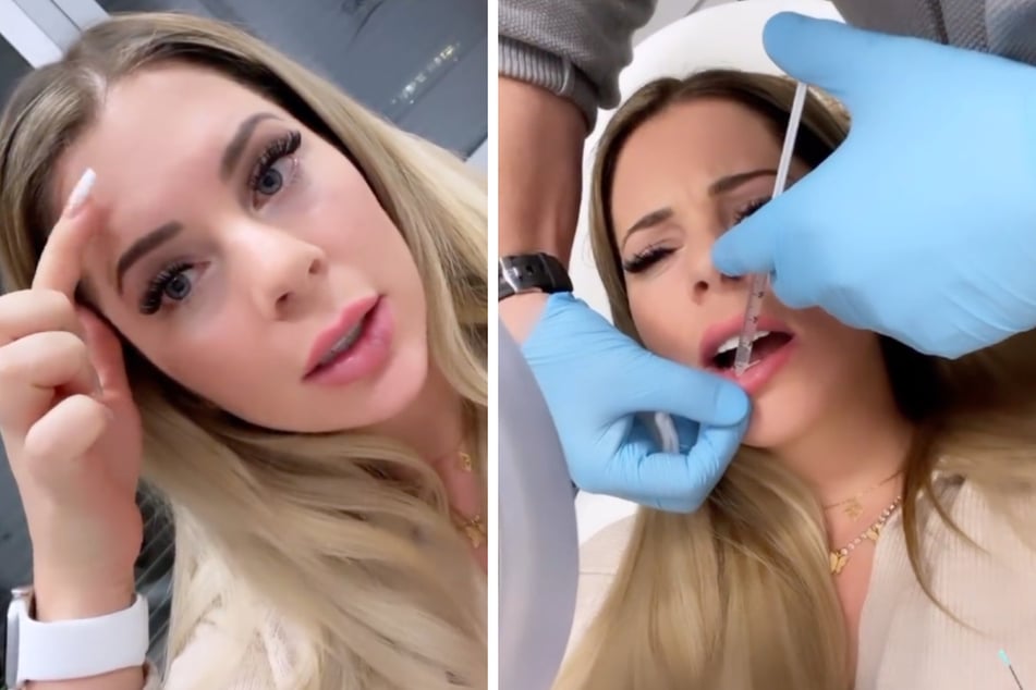 Lasern an der Stirn, Spritze in die Lippe: Was ist denn bei Jenny Frankhauser los?!