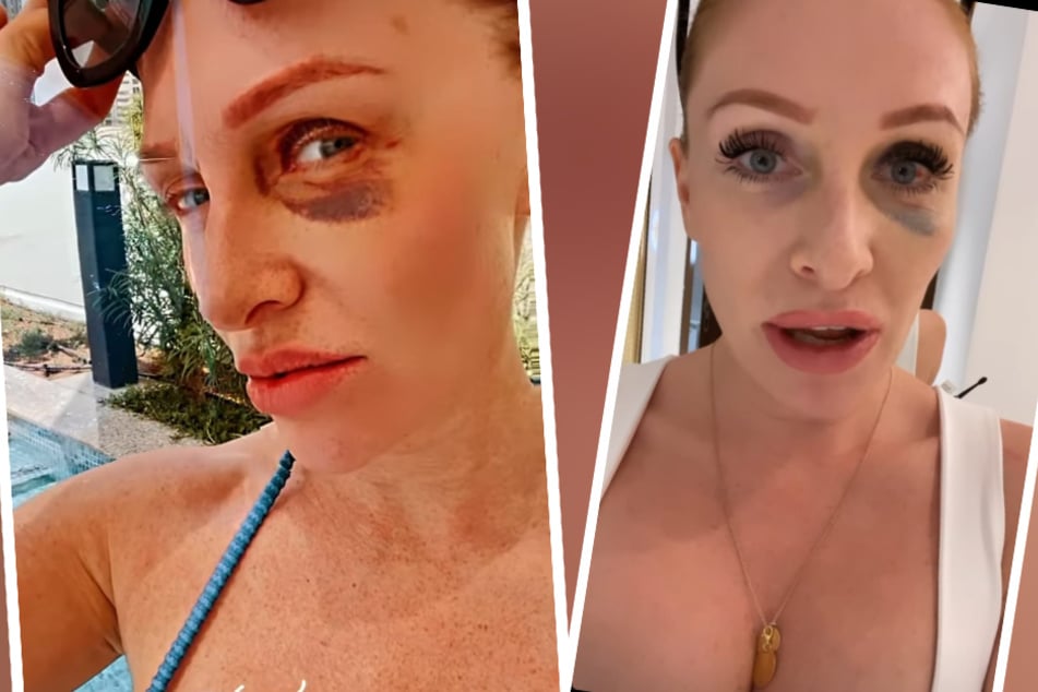 Drama um Georgina Fleur: Kubilay wünschte ihr an ihrem Geburtstag den Tod!